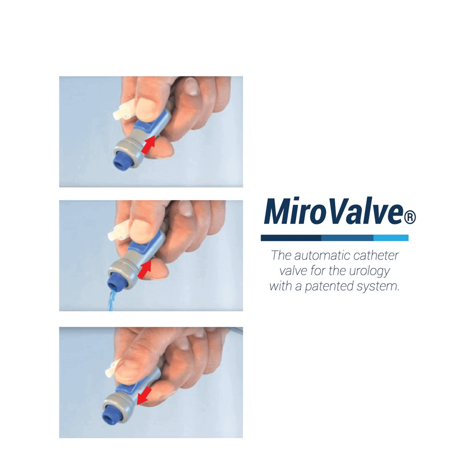 Miro Valve Sterile Automatic Urology Valve